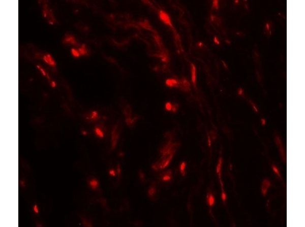 Immunofluorescence of WFDC2