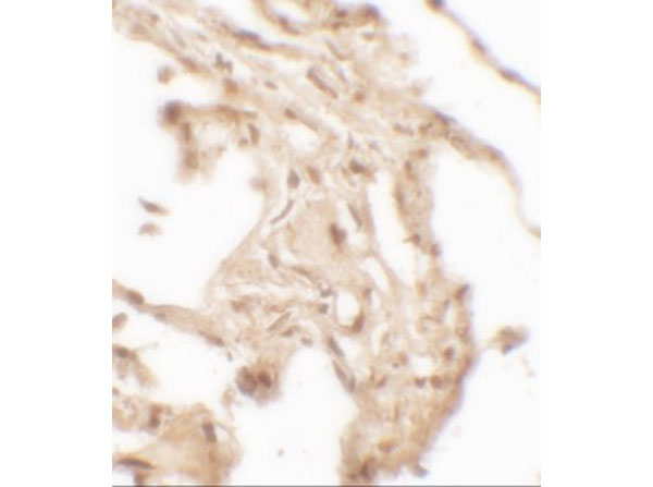 Immunohistochemistry of WFDC2