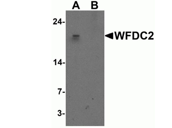 Western blot of WFDC2