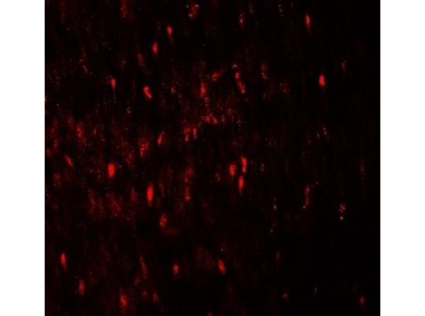 Immunofluorescence of WIPI1