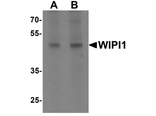 Western blot analysis of WIPI1