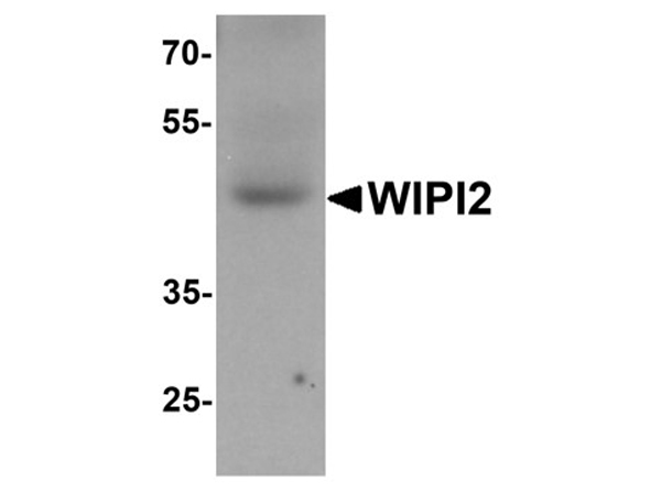 Western blot analysis of WIPI2