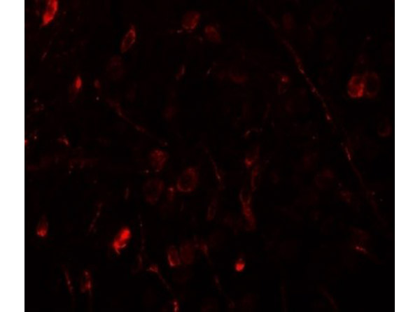 Immunofluorescence of WIZ