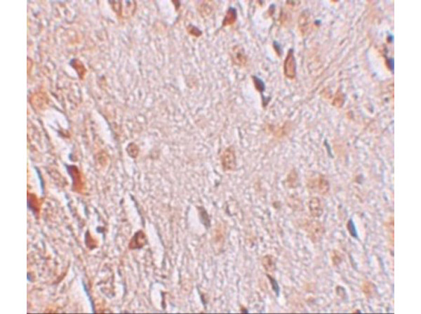 Immunohistochemistry of WIZ