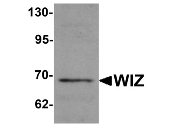 Western blot analysis of WIZ