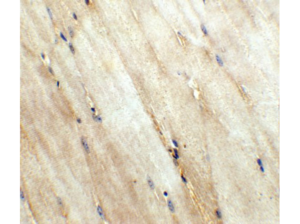 Immunohistochemistry of Wnt10a