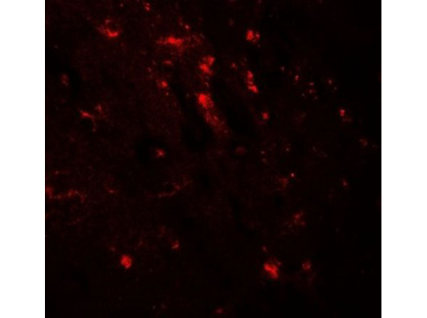Immunofluorescence of WWC1