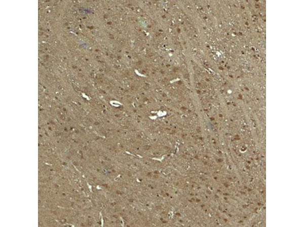 Immunohistochemistry of WWC1