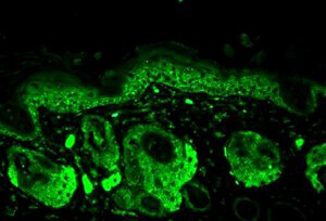 Mn SOD Immunofluorescence