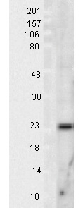 SOD2 Western Blot