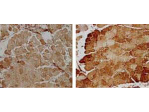 SOD2 Immunohistochemistry