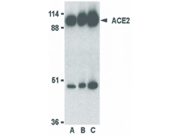 Western Blot of Rabbit Anti-ACE2 Antibody