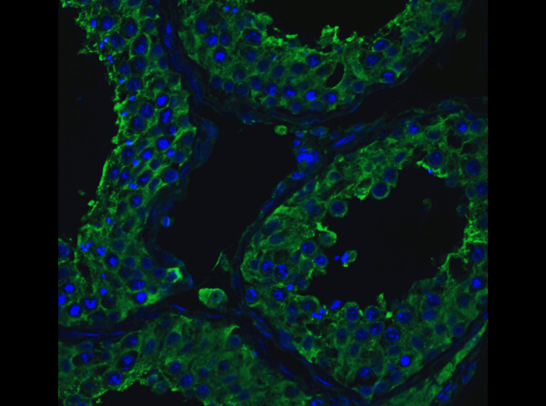 Immunofluorescence of Rabbit Anti-ACE2 Antibody