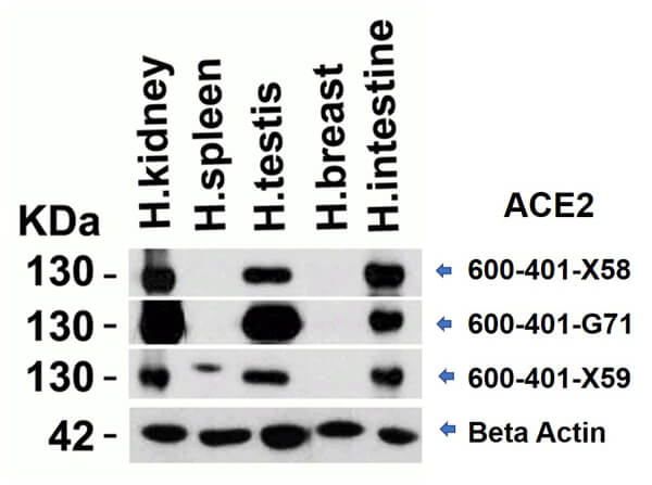 Western Blot of different Rabbit anti-ACE2 antibodies.