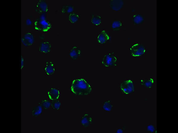 Immunofluorescence of Rb ACE2 Antibody.