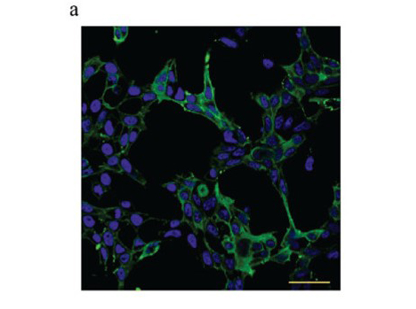 Immunofluorescence using ACE2