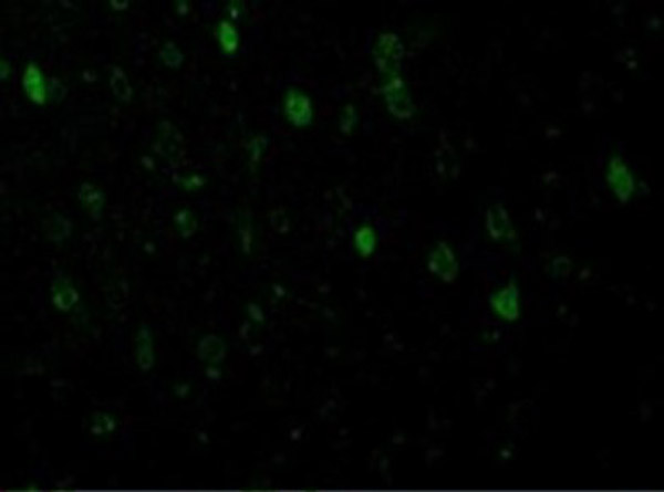 Immunofluorescence of Adiponectin