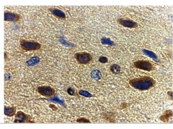 Immunohistochemistry of adiponectin