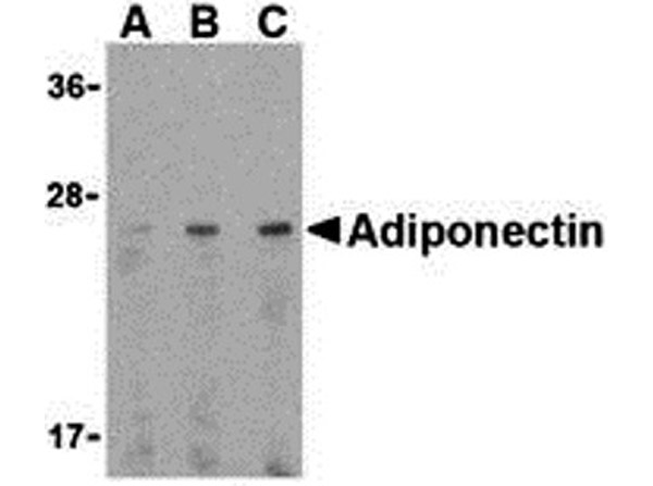 Western blot analysis of adiponectin