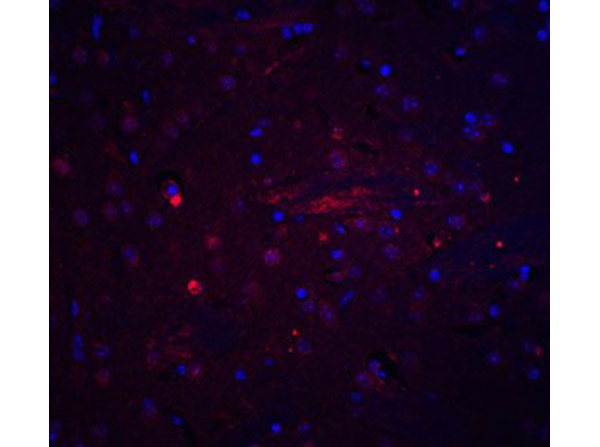 Immunofluorescence of Adiponectin