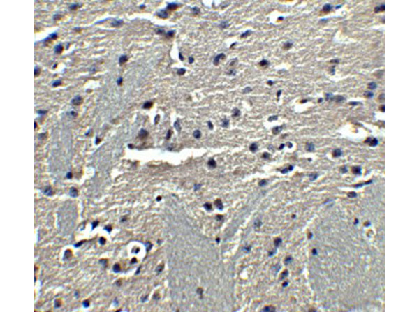 Immunohistochemistry of adiponectin