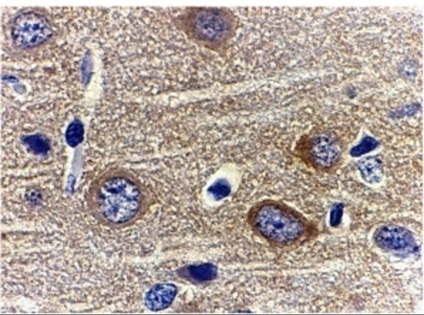 Immunohistochemistry of adiponectin