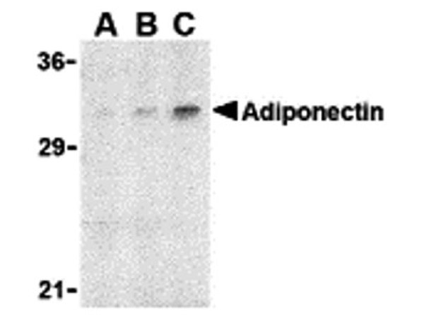 Western blot analysis of adiponectin