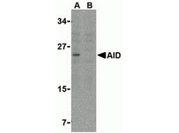 Western blot analysis of AID