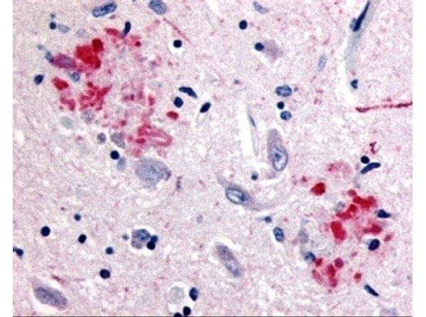 Immunohistochemistry of APP