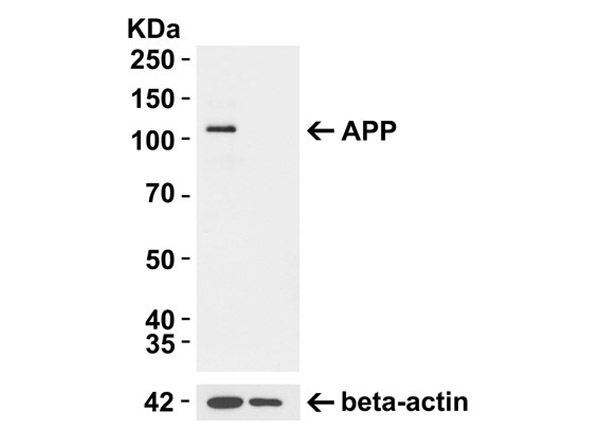 Western Blot of Anti-APP