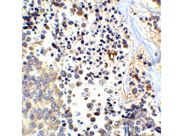 Immunohistochemistry of APP