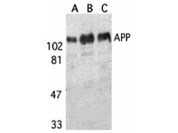 Western Blot of Anti-APP