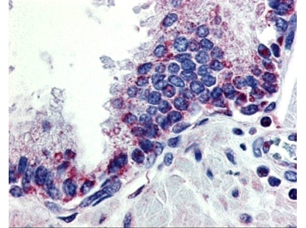 Immunohistochemistry of APRIL