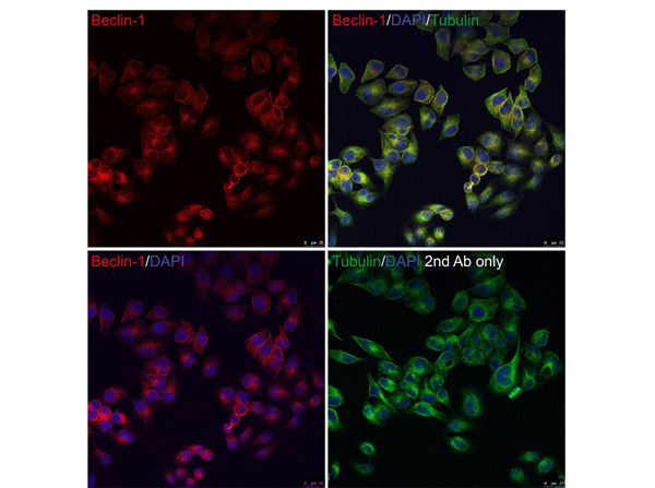 Immunofluorescence of Beclin-1