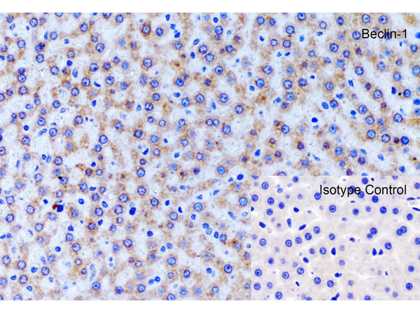 Immunohistochemistry of Beclin-1