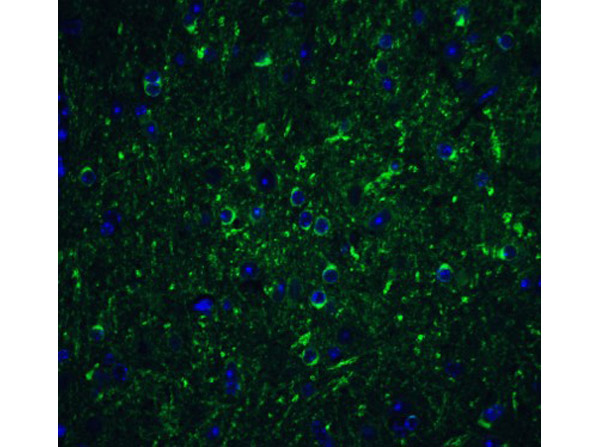 Immunofluorescence of Beclin-1