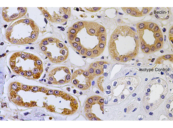 Immunohistochemistry of Beclin-1