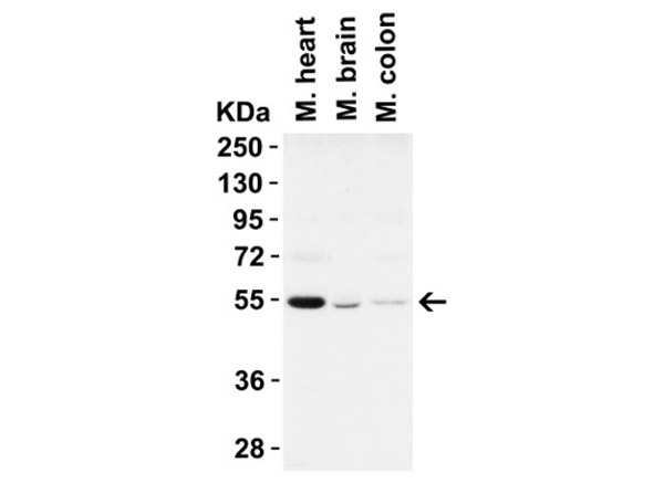 Western Blot of Beclin-1