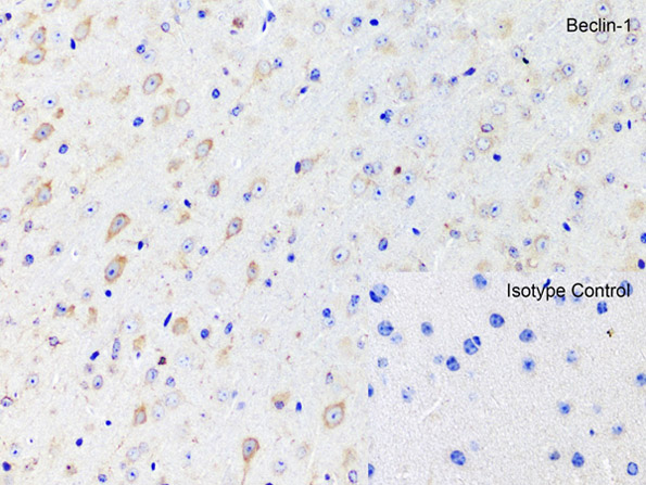 Immunohistochemistry of Beclin-1