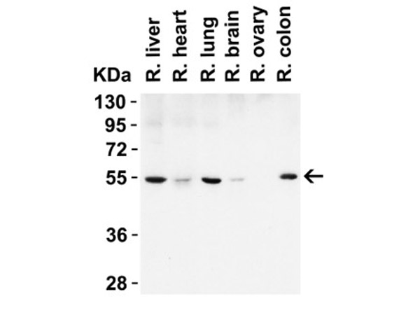 Western Blot of Beclin-1