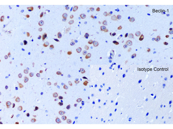 Immunohistochemistry of Beclin-1