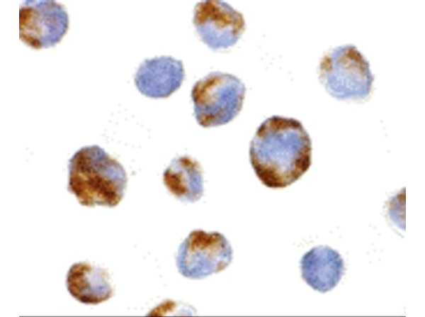 Immunocytochemistry of BMI-1