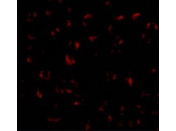 Immunofluorescence of BMI-1