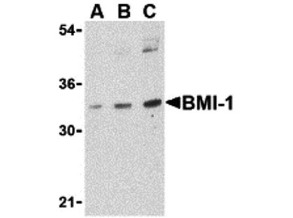 Western blot analysis of BMI-1