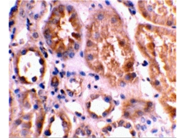 Immunohistochemical staining using Anti-BNIP3