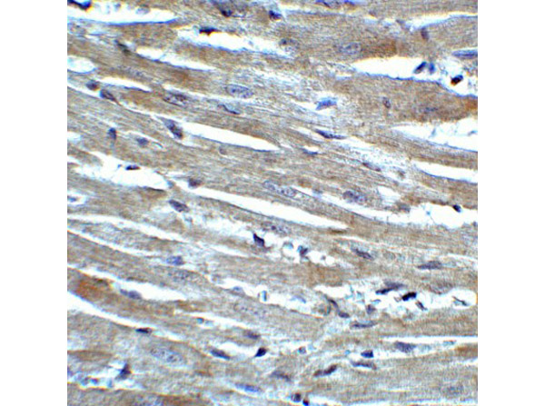 Immunohistochemistry of CX3CR1