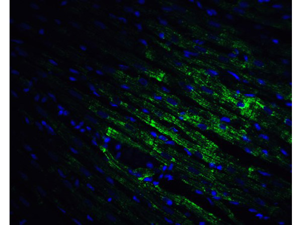 Immunofluorescence Validation of CX3CR1