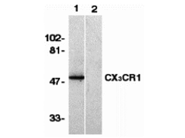 Western Blot of CX3CR1