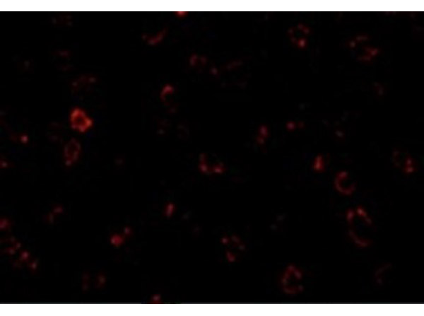 Immunofluorescence of CX3CR1