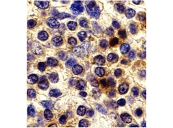 Immunohistochemistry of CX3CR1